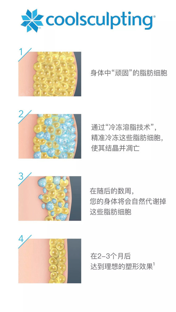 最新溶脂技术,前沿溶脂科技